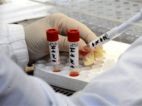 კორეელმა მეცნიერებმა H1N1 ვირუსის გამანადგურებელ პრეპარატს მიაგნეს